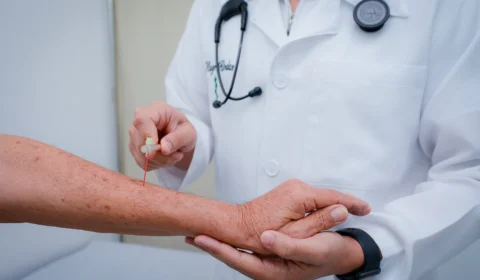 Hanseníase: mais de 30 casos foram registrados em Boa Vista-RR em 2023