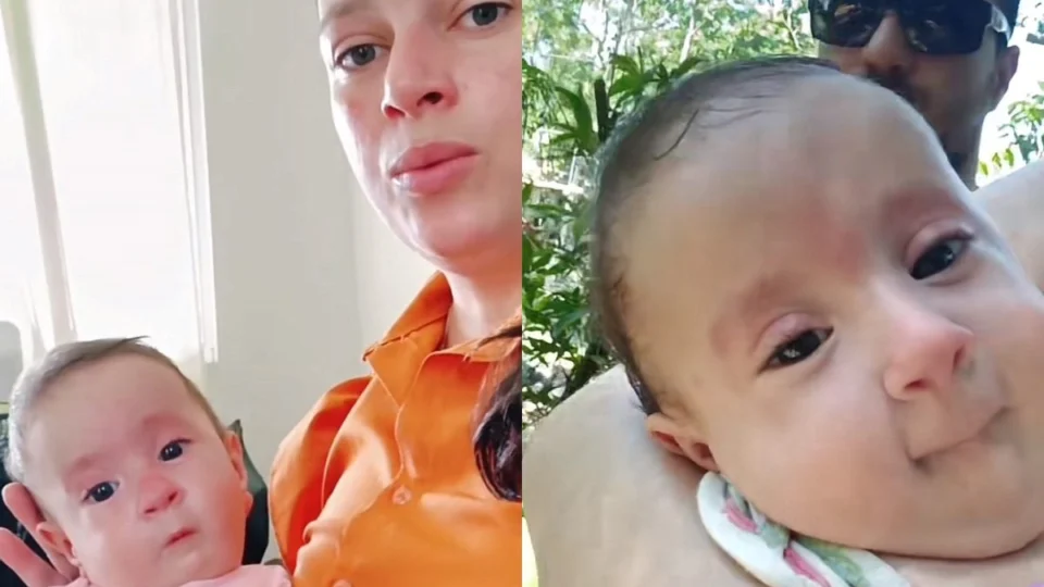 Bebê nasce sem braços e sem pernas e história comove web