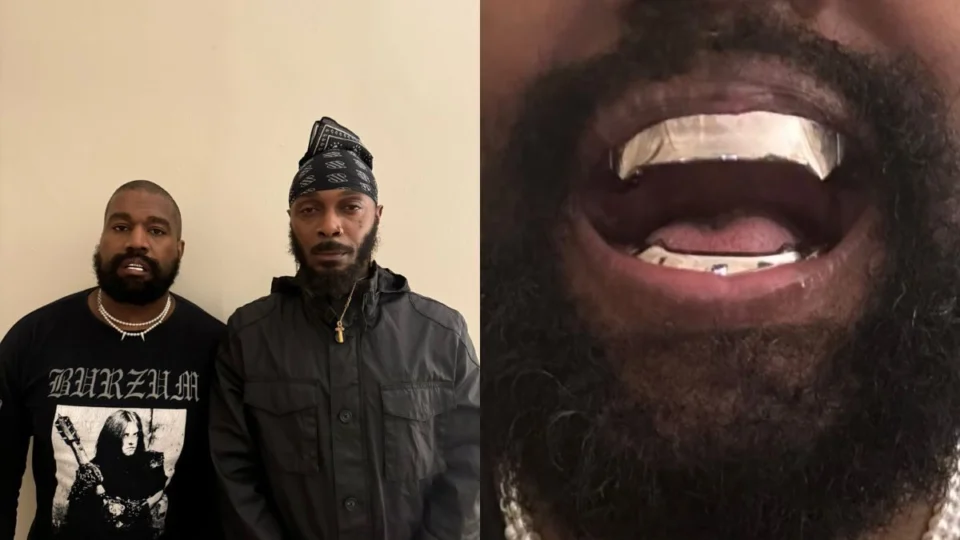 Kanye West coloca dentes de titânio avaliados em R$ 4 milhões; veja imagem