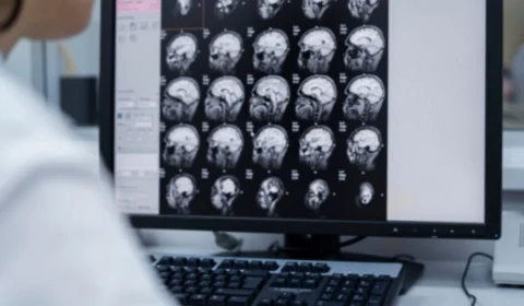 Alzheimer: novos estudos mostram 5 diferentes subtipos da doença