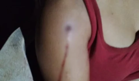 Feminicídio em Roraima: mulher com medida protetiva é morta a tiros pelo ex