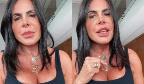 Gretchen celebra novo procedimento estético; veja o resultado