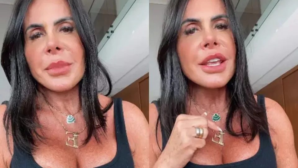 Gretchen celebra novo procedimento estético; veja o resultado