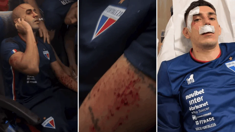 Jogadores do Fortaleza são hospitalizados após ataque em Pernambuco; veja vídeos
