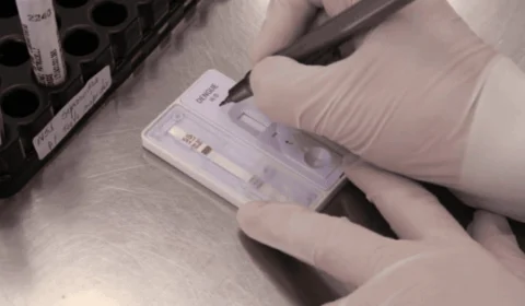 Primeira morte por dengue em Rondônia é confirmada