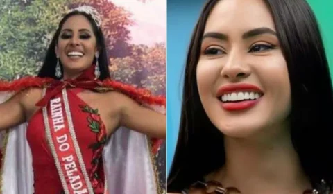 BBB 24: Médico e mãe de Isabelle revelam procedimentos estéticos feitos pela sister