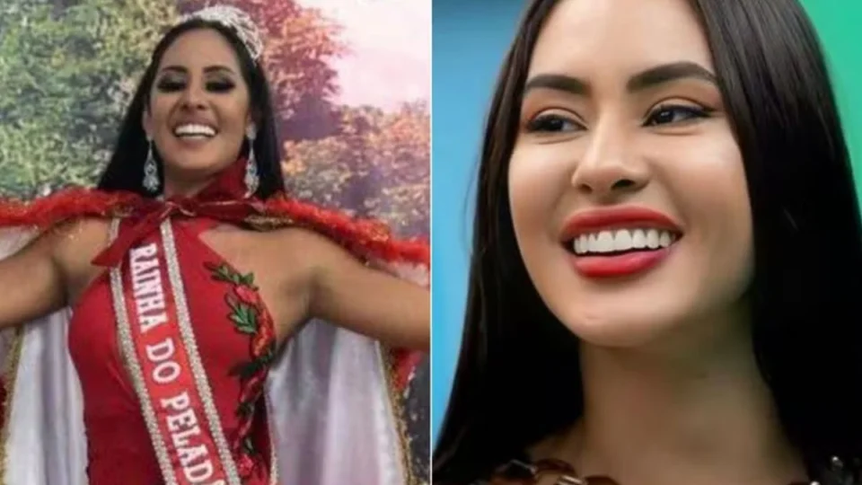 BBB 24: Médico e mãe de Isabelle revelam procedimentos estéticos feitos pela sister