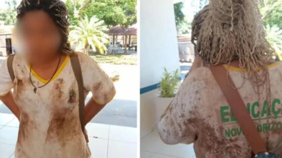 Preconceito de raça ou cor: psicólogos de Roraima repercutem caso que chocou o Brasil