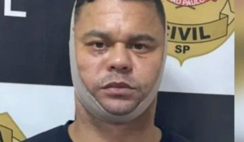 Bandido da ‘Cara Quadrada’ é preso durante cirurgia para alterar o rosto