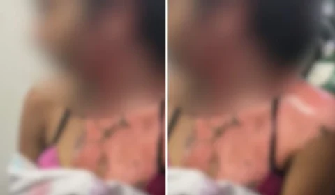 VÍDEO FORTE: mulher queima sobrinha e grava tudo com o celular