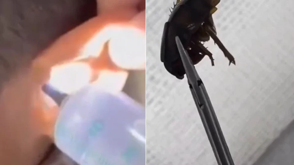 VÍDEO: médico retira barata e sementes de melancia do ouvido de criança