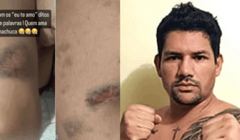 Cantora gospel sofre violência de ex-namorado, no AM: ‘Ele falou que ia acabar com a minha vida’