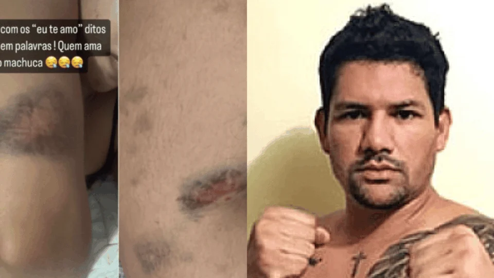 Cantora gospel sofre violência de ex-namorado, no AM: ‘Ele falou que ia acabar com a minha vida’