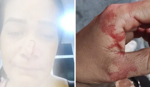 Aluguel de carro acaba em violência: ‘covarde por bater em uma mulher’