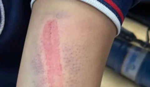 Mãe e padrasto são presos por espancar jovem de 15 anos em Manaus