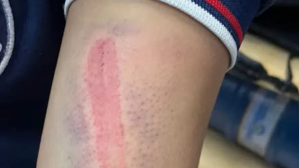 Mãe e padrasto são presos por espancar jovem de 15 anos em Manaus