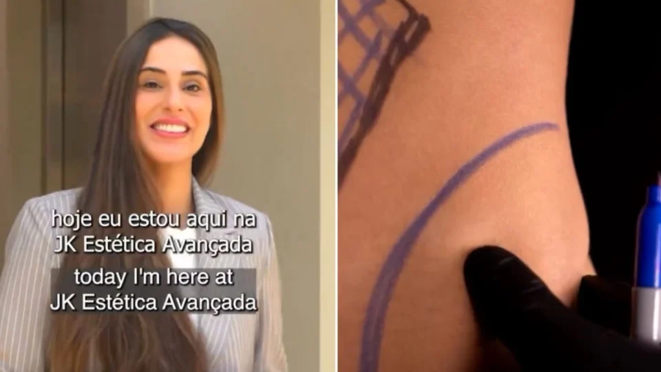 Vídeo: Deniziane mostra resultado de cirurgias no corpo e nos seios