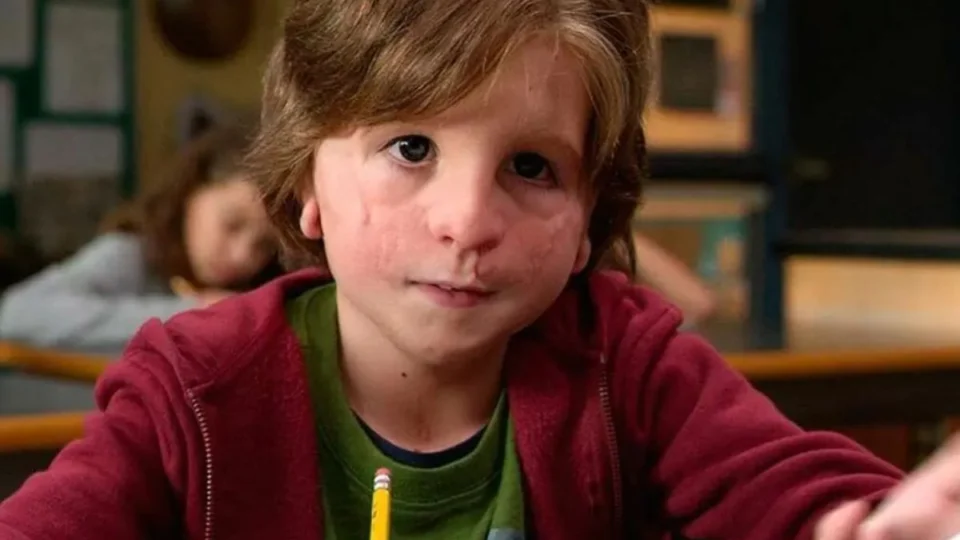 Ator de Extraordinário surge irreconhecível em fotos