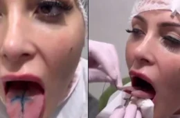 Andressa Urach faz procedimento de ‘língua de cobra’; veja vídeo