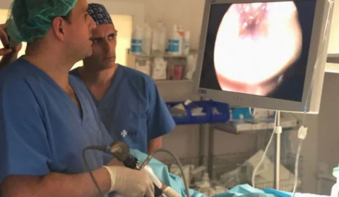 Hiperplasia prostática: novo tratamento é testado em Manaus; veja