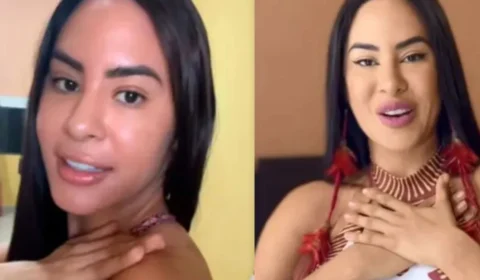 Em vídeo, Isabelle mostra “feridas” após Festival de Parintins