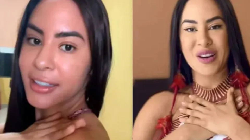 Em vídeo, Isabelle mostra “feridas” após Festival de Parintins