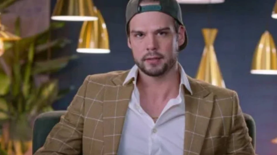 Casamento às Cegas: calvo do reality decide fazer transplante capilar