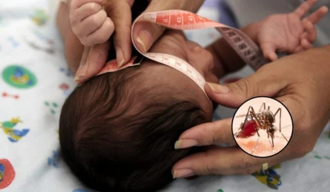 Febre Oropouche: doença pode provocar surto de microcefalia