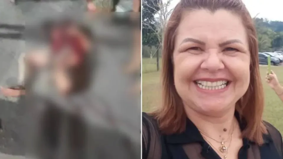 Mulher morre em hospital após ter perna arrancada em acidente no AM