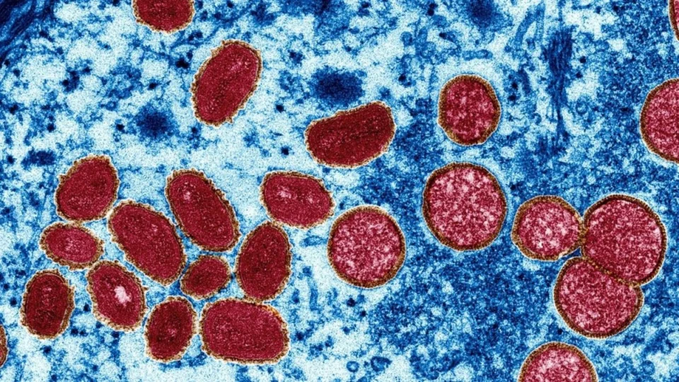 OMS declara que Mpox é uma emergência sanitária global