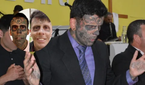 Homem mais tatuado do Brasil remove tattoos; veja antes e depois