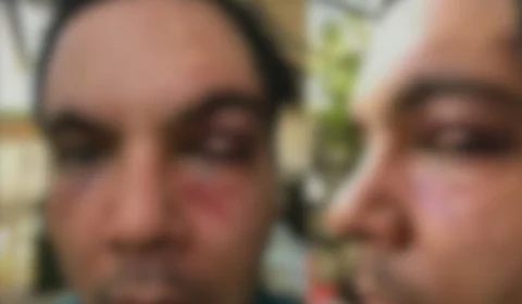 Instituto Mundo Azul fala sobre autista espancado em Manaus: ‘triste realidade’