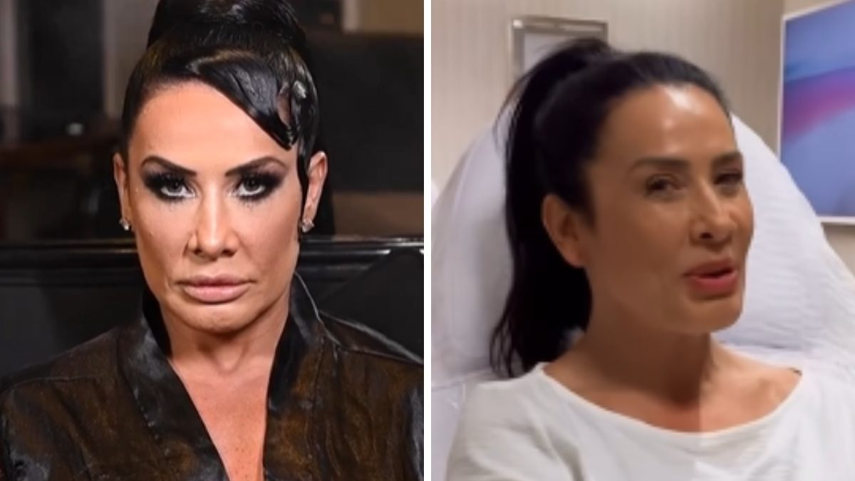 Antes e depois - Foto: Reprodução/Instagram