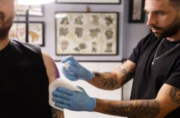 Remoção de tatuagem: saiba como funciona o procedimento