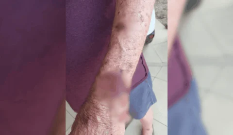 Delegado aposentado é agredido em Palmas