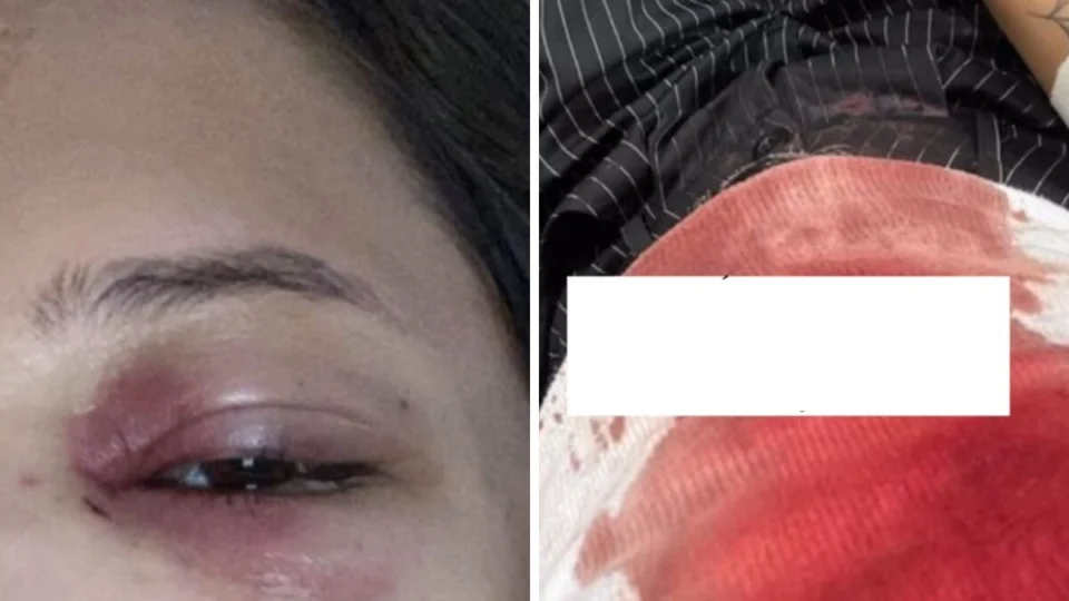 Jovem esbarra acidentalmente em homem e é agredida a socos em RO