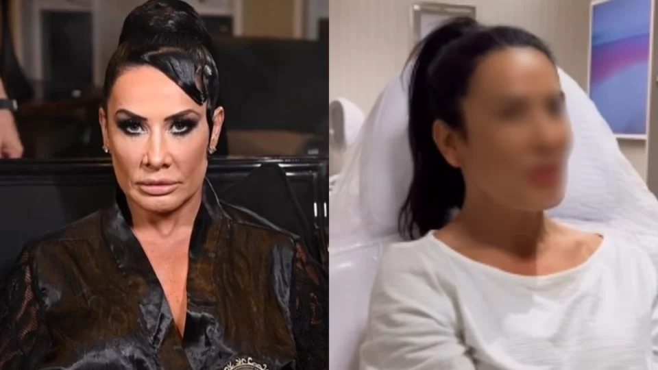 Scheila Carvalho remove preenchimento; veja antes e depois