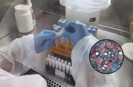 Mpox: aumento expressivo de casos acende alerta no Amazonas