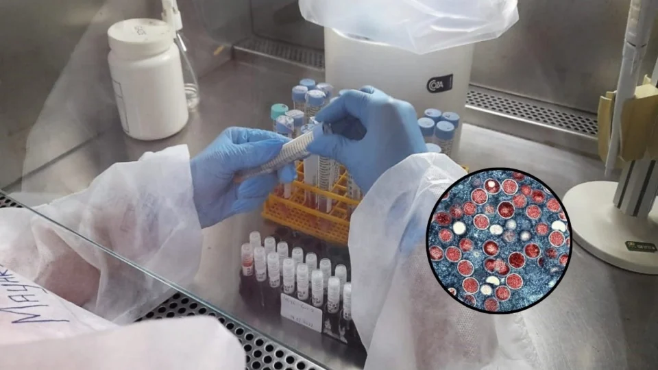 Mpox: aumento expressivo de casos acende alerta no Amazonas