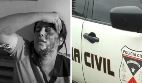 Apoiadora de candidata a prefeita leva pedrada na cabeça em Primavera de Rondônia