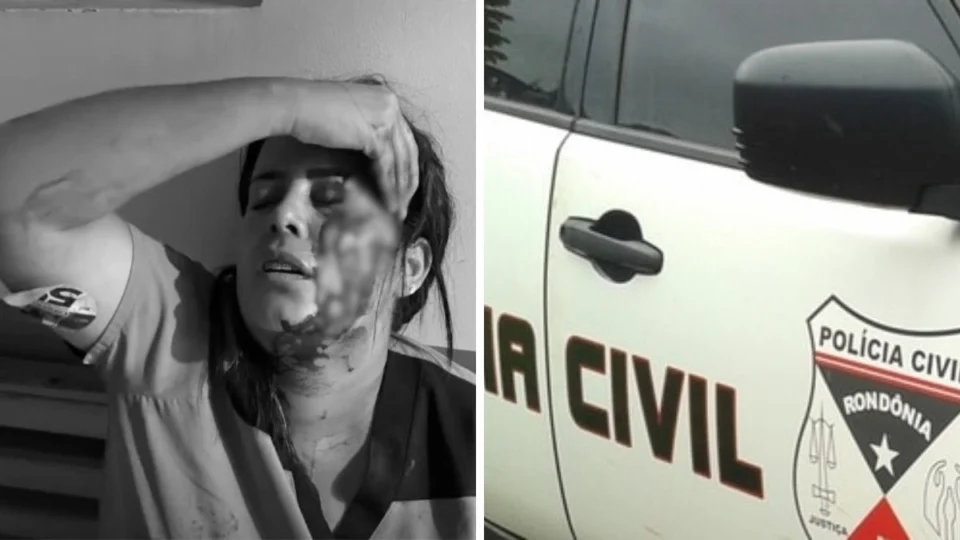 Apoiadora de candidata a prefeita leva pedrada na cabeça em Primavera de Rondônia