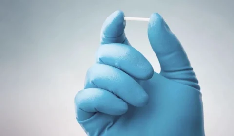 Chip da beleza: entenda o que é, como funciona e os efeitos colaterais