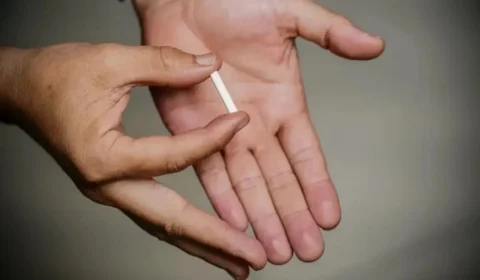 Senado vai debater a suspensão do ‘chip da beleza’ pela Anvisa