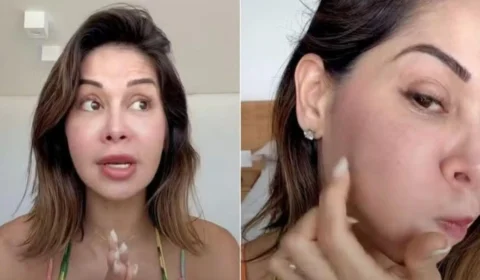 PMMA: saiba quais são os riscos da substância que causou inchaço no rosto de Maíra Cardi