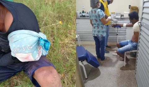 Pescador tem braço amputado após ataque de jacaré em Barreirinha, interior do Amazonas