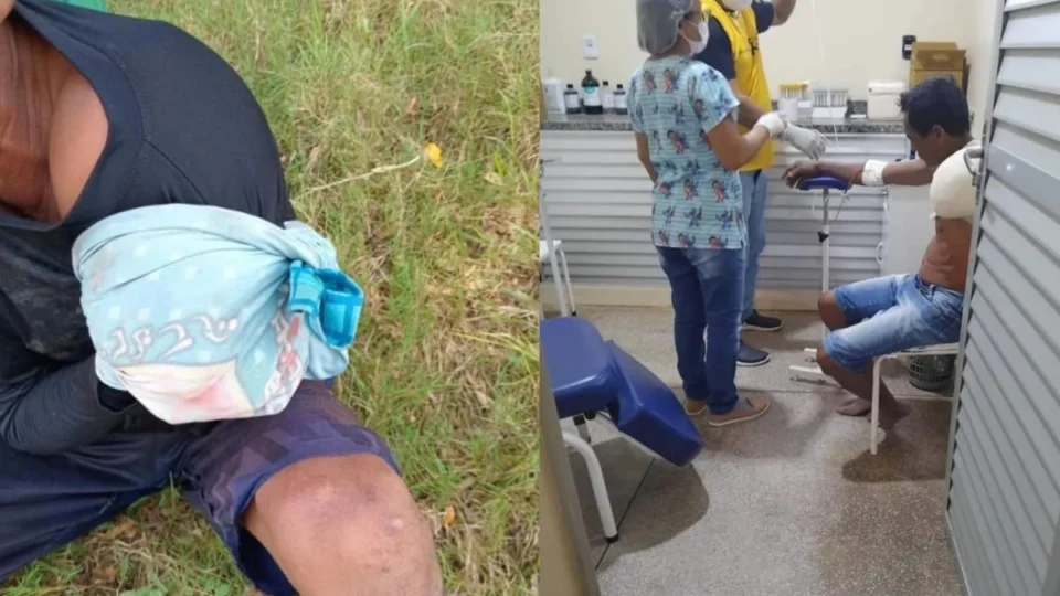 Pescador tem braço amputado após ataque de jacaré em Barreirinha, interior do Amazonas