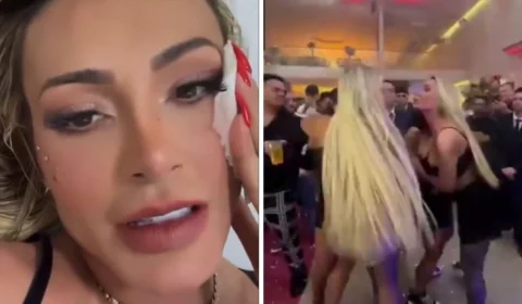 Depois de briga, Andressa Urach expõe rosto ferido por Juju Ferrari