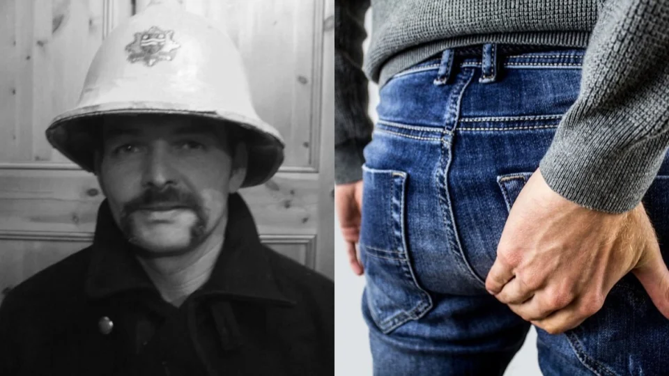 Homem é internado com sintomas de gripe e só recebe alta após remover pedaço da nádega; entenda