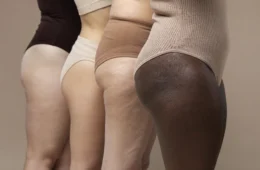 Como reduzir celulite? 4 dicas infalíveis para cuidar da sua aparência