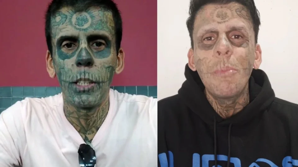 Homem ‘mais tatuado do Brasil’ enfrenta sessões de remoção de tatuagens em busca de recomeço